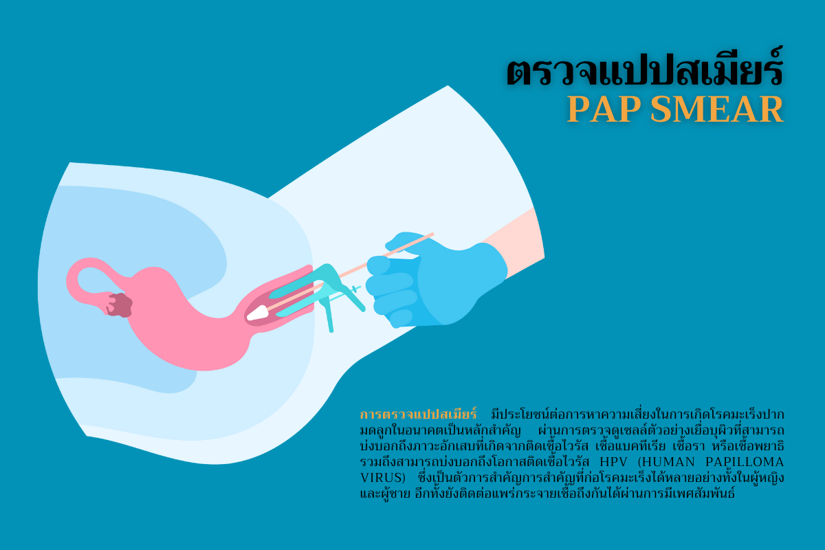 ตรวจแปปสเมียร์ (Pap smear)