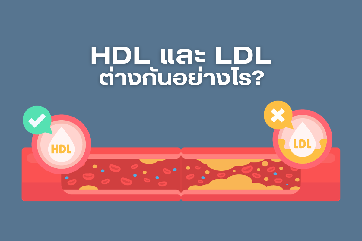 HDL และ LDL ต่างกันอย่างไร