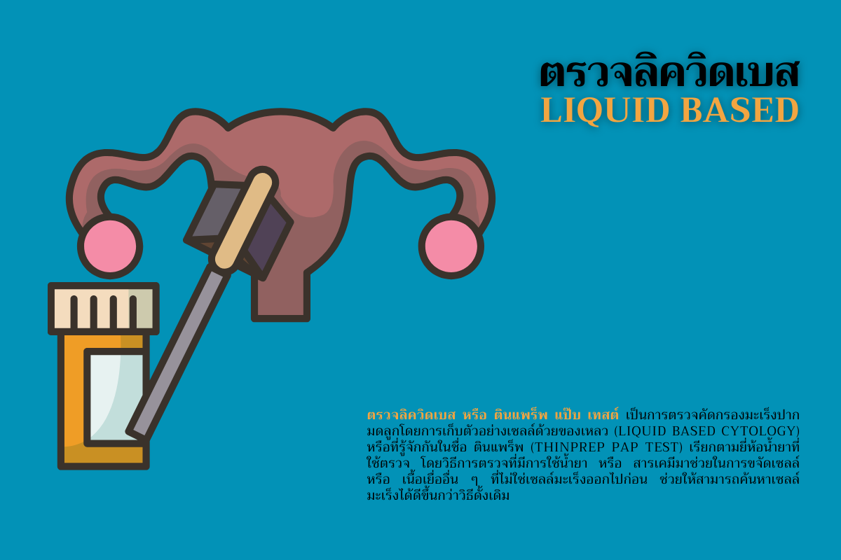 ตรวจลิควิดเบส (Liquid based)