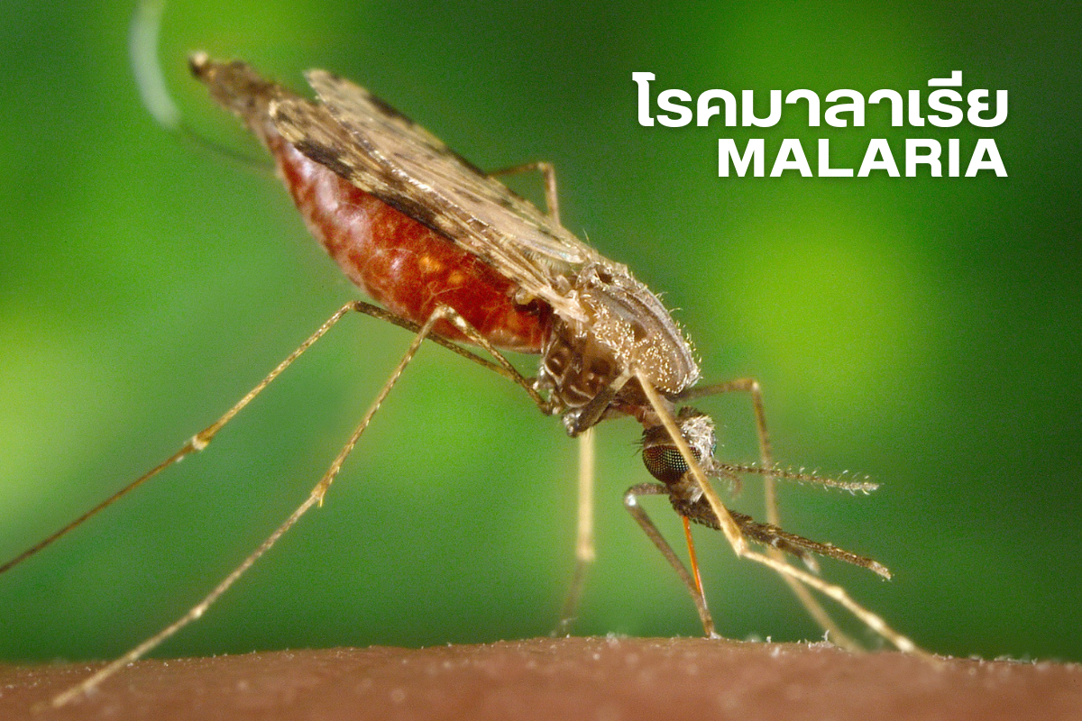 โรคมาลาเรีย
