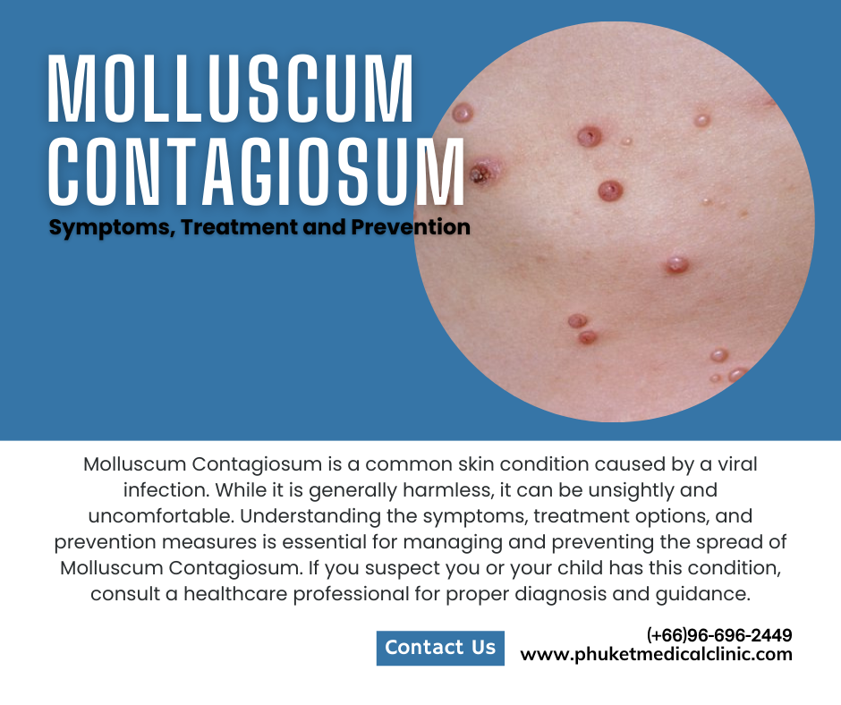 Molluscum Contagiosum Symptoms Treatment And Prevention Phuket Medical Clinic