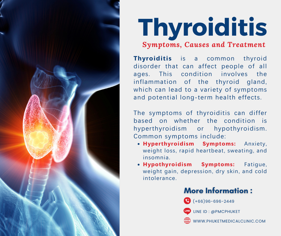 Thyroiditis Symptoms, Causes and Treatment