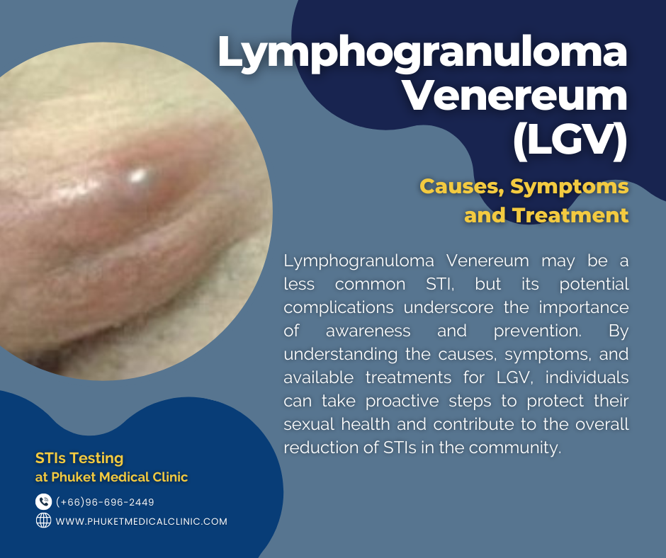 Lymphogranuloma Venereum (LGV) Causes, Symptoms and Treatment