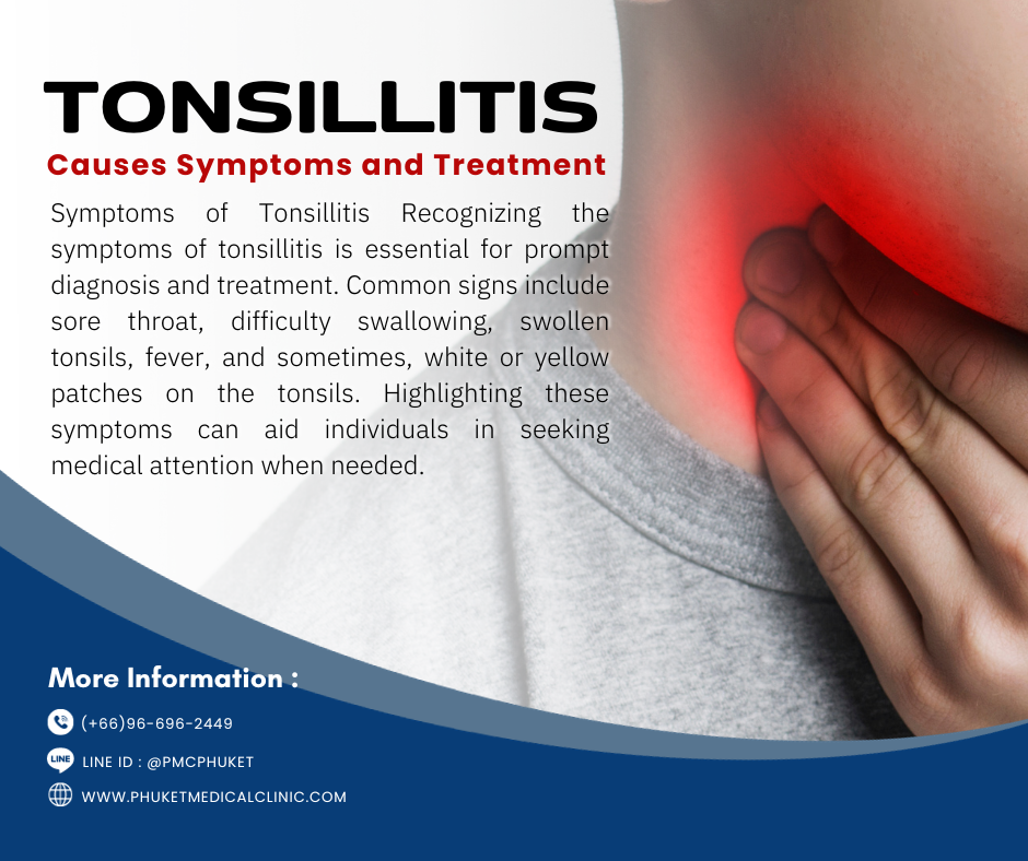 Tonsillitis Causes Symptoms and Treatment