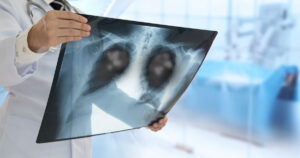 pneumonia in thailand